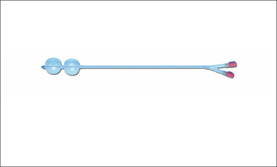 多次使用球囊導管對子宮頸有何潛在影響？