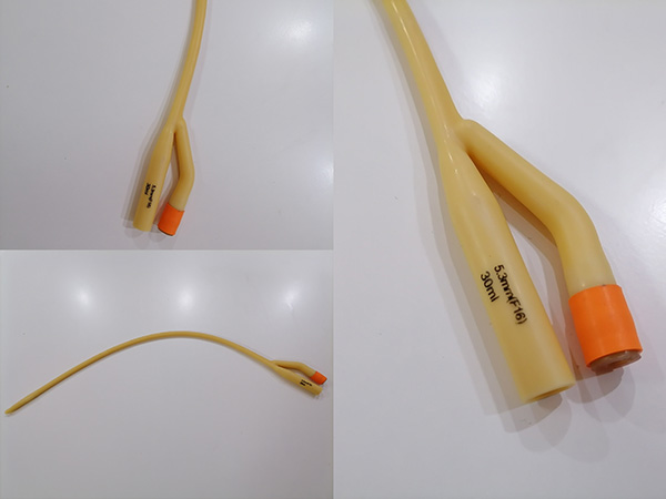 導(dǎo)尿管周圍紅腫、流膿？感染信號(hào)要重視